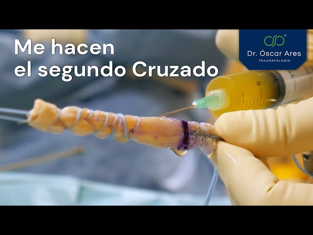 Me hacen el segundo cruzado - Dr. Oscar Ares