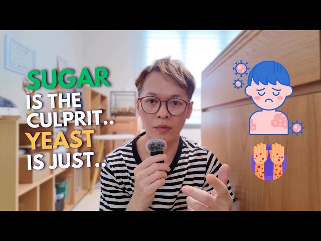 #13 Sugar Yeast Relationship, The Major Cause Of Your ECZEMA