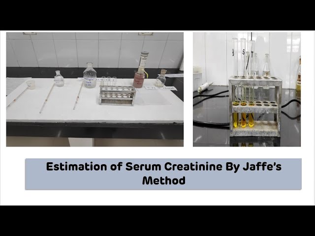 Estimation of Serum Creatinine By Jaffe's Method on Colorimeter || Biochemistry Practical