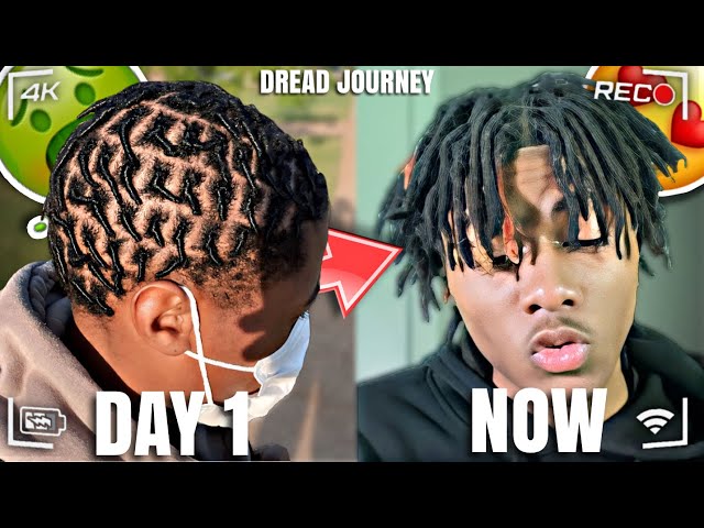 My Dreadlock Journey I 2 Year Transformation‼️ *CRAZY GROWTH*