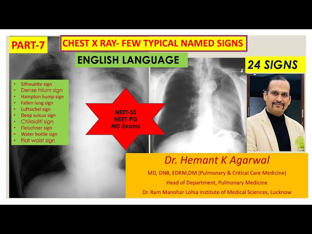 Chest X Ray-7 Typical Named Sign (ENGLISH)/ Pulmonary Radiology #NEET-SS Pulmonary Medicine @Hemant