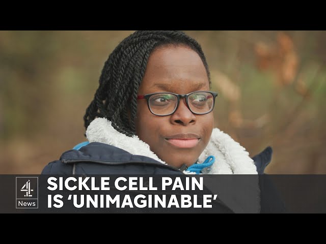 UK health: NHS approves groundbreaking sickle cell treatment