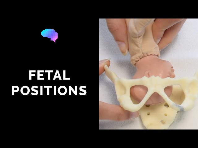 Types of Fetal Positions - OSCE Guide | UKMLA | CPSA | PLAB 2