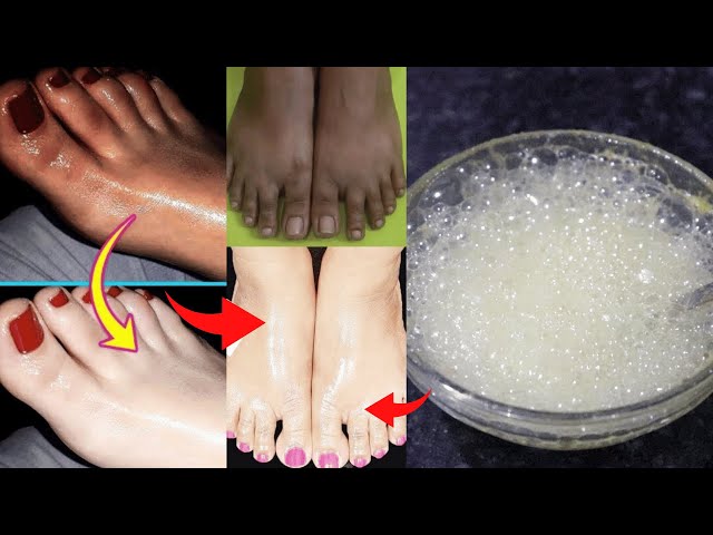 Foot and hand Whitening Bleach.Remove years of grime and dirt in one minute.