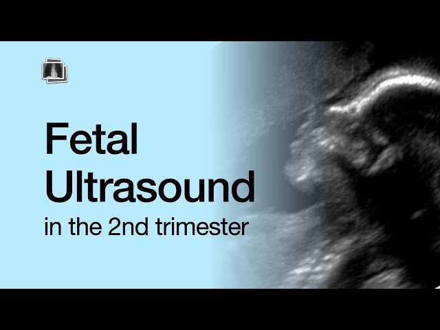 Fetal Ultrasound in the 2nd Trimester