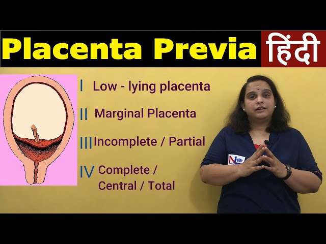 Placenta Previa in Hindi | APH Antepartum Hemorrhage-Types, Risk factors, Symptoms | Nursing Lecture