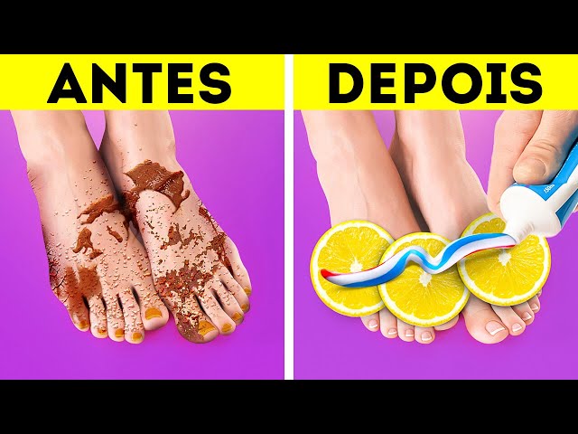 Pedicure simples e truques para os pés que você deve conhecer