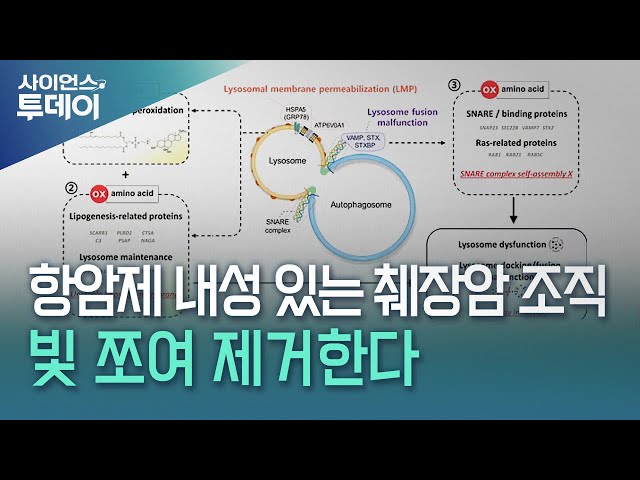 항암제 내성 있는 췌장암 조직, 빛 쪼여 제거한다 / YTN 사이언스