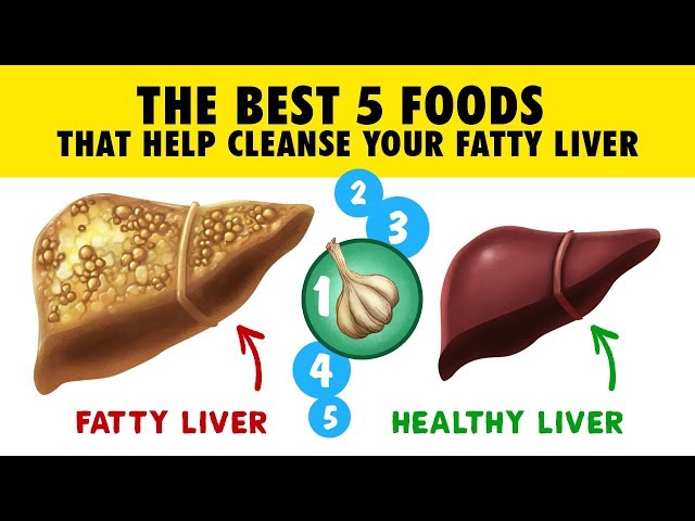 🍊 THE BEST 5 Foods That Help Cleanse Your Fatty Liver