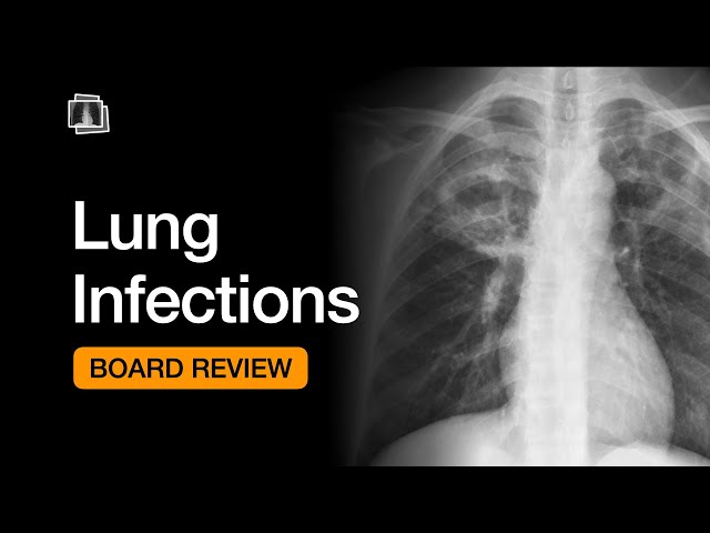 Lung Infections | Chest Radiology Board Review