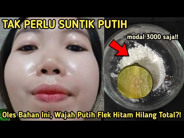 TAK PERLU SUNTIK PUTIH!! MODAL 3000 WAJAH PUTIH FLEK HITAM HILANG TOTAL?! MEMUTIHKAN WAJH PERMANEN