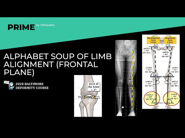 Alphabet Soup of Limb Alignment (Frontal Plane) - Philip McClure, MD