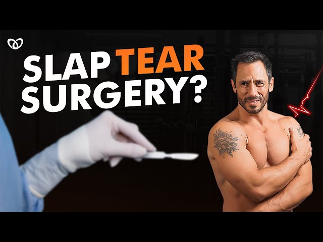 Surgeons Are Lying To You About SLAP Tear Rehab