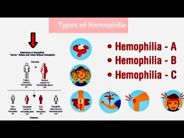 22.14 Haemophilia | Types|  Patterns of Inheritance | X-Linked Recessive Disorders| Class 12 Biology