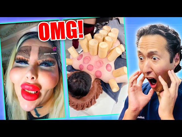 Plastic Surgeon Reacts to OUTRAGEOUS TikToks!