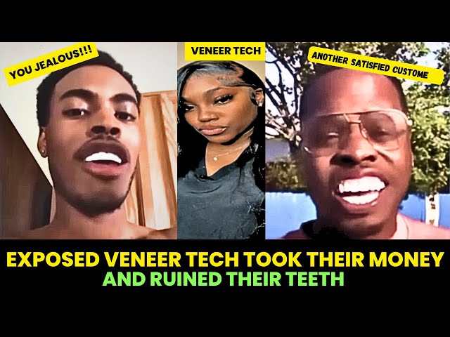 THIS GHETTO DENTIST PUT GIGANTIC VENEERS IN HER MOUTH