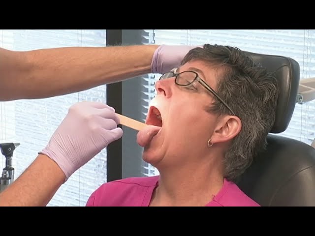 How to spot early symptoms of oral cancer