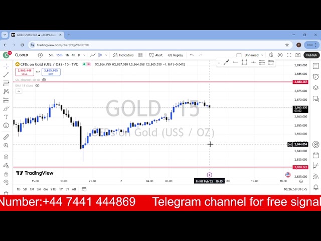 GOLD DAILY FORCAST UPDATE | 07 FEBRUARY 2025 | XAUUSD|