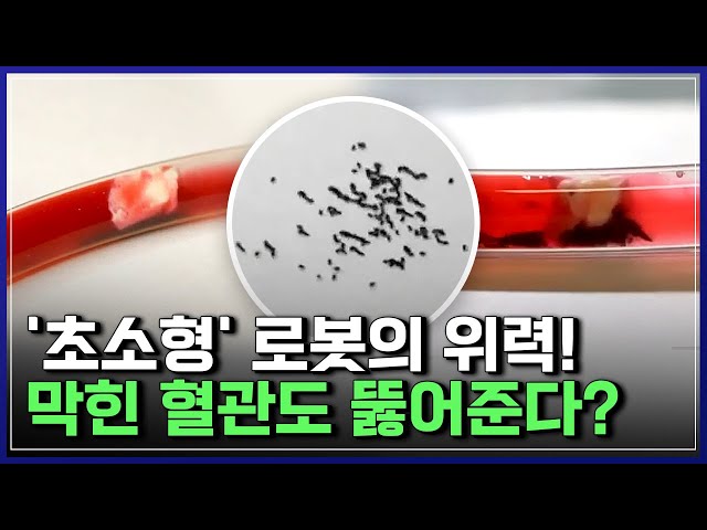 '초소형' 로봇의 위력! 막힌 혈관도 뚫어준다?...놀라운 한국 로봇 기술! | 브라보 K-사이언티스트 [반복재생]/YTN 사이언스