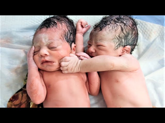 Twin newborn Baby trying to Pinch his Big brother's face after birth are Cute