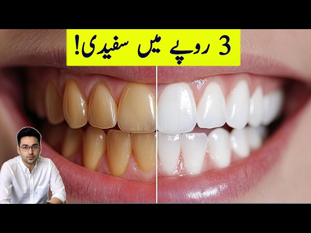 Dr. Zee:Teeth Whitening at Home | डॉक्टर ज़ी