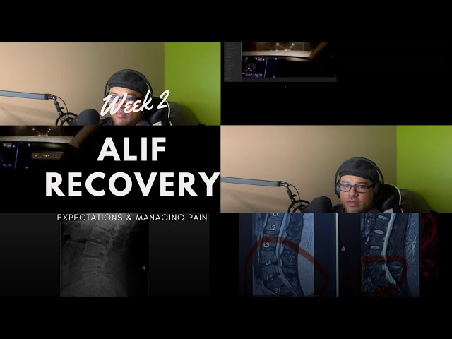 ALIF Surgery Update: 2 Weeks of RECOVERY and HEALING!