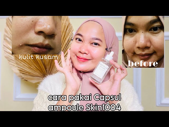 cara pakai skin1004 Capsul ampoule | Serum untuk mencerahkan kulit wajah