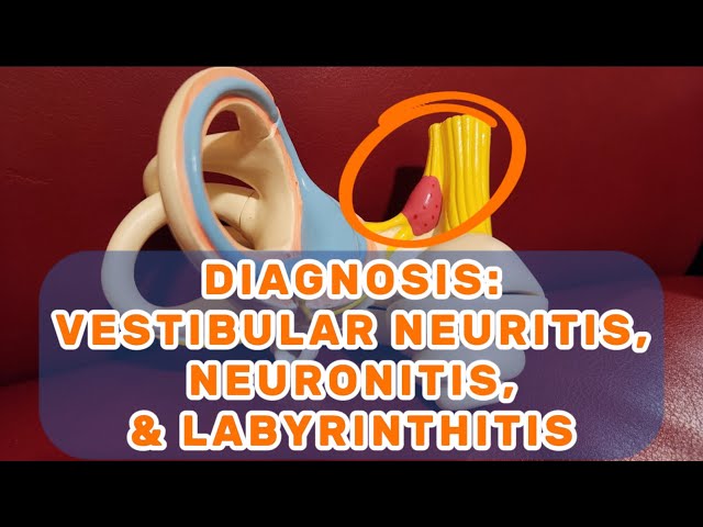 DIAGNOSIS: Vestibular Neuritis, Neuronitis, & Labyrinthitis - Dizzy Therapy