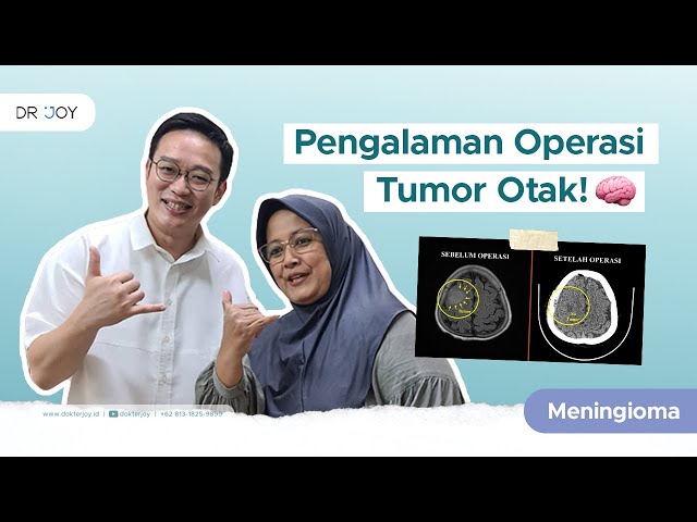 Operasi Tumor Otak Meningioma dengan Microsurgery! | Cerita Tumor Otak #14