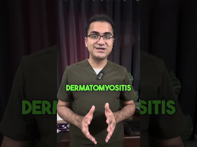 Prodoc Tip 47 Dermatomyositis and Importance of Malignancy Screening USMLE NEETPG