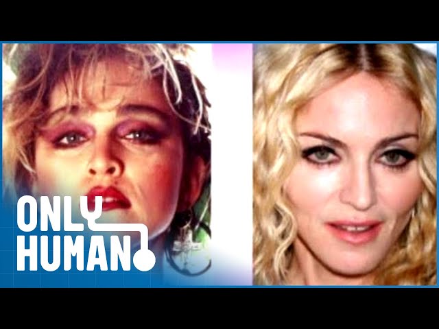 More Greatest Plastic Surgery Shockers | Only Human