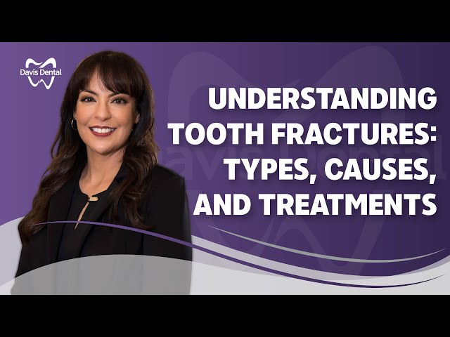 Understanding Tooth Fractures: Types, Causes, and Treatments | Davis Dental