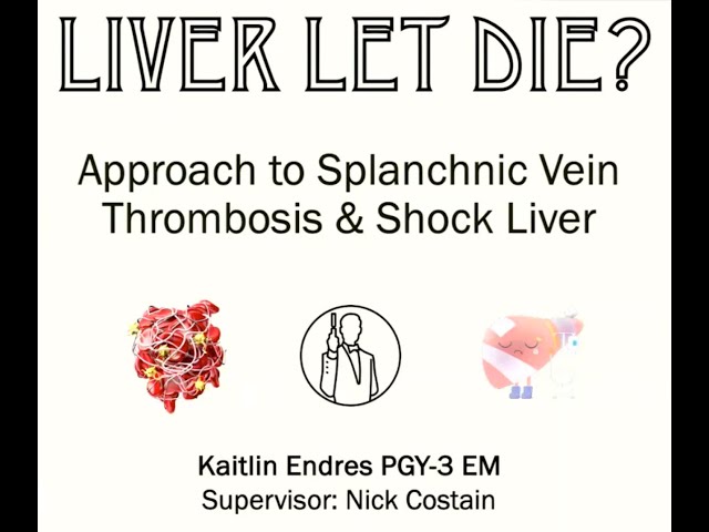 Liver Let Die: An Approach to Hepatic Vascular Thrombosis & Shock Liver