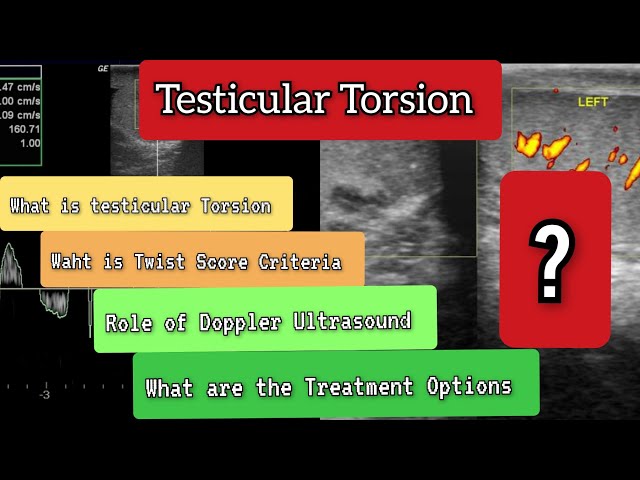 What is Testicular Torsion? 💯 Role of Ultrasound in diagnosis #health #medical #ultrasound