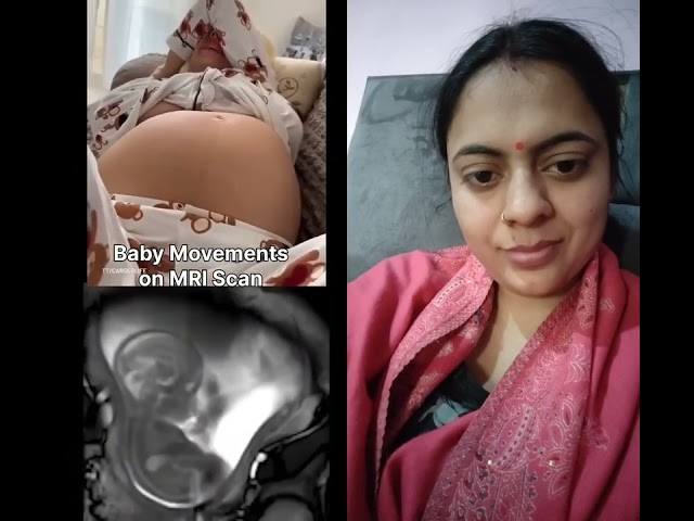 Cute little baby 🥰🥰#shortvideo #pregnant #cutebaby