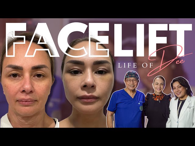 Donita Rose, Nagpa-Facelift??? | Life of Dee Ep. 1