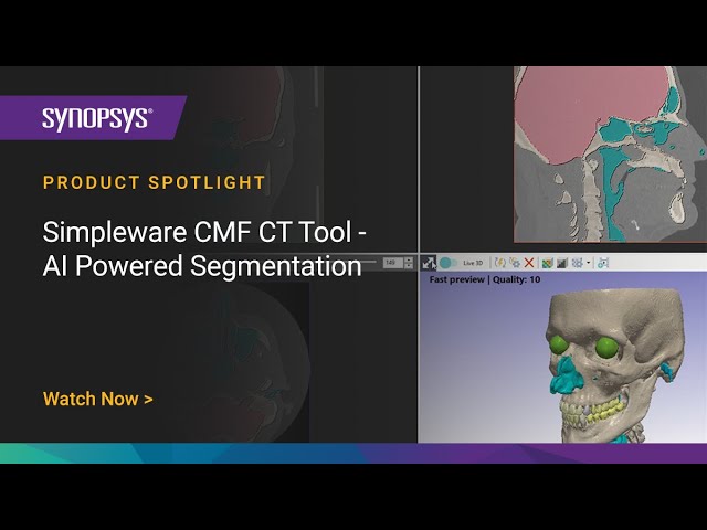 Simpleware CMF CT Tool - AI-Powered Segmentation | Synopsys