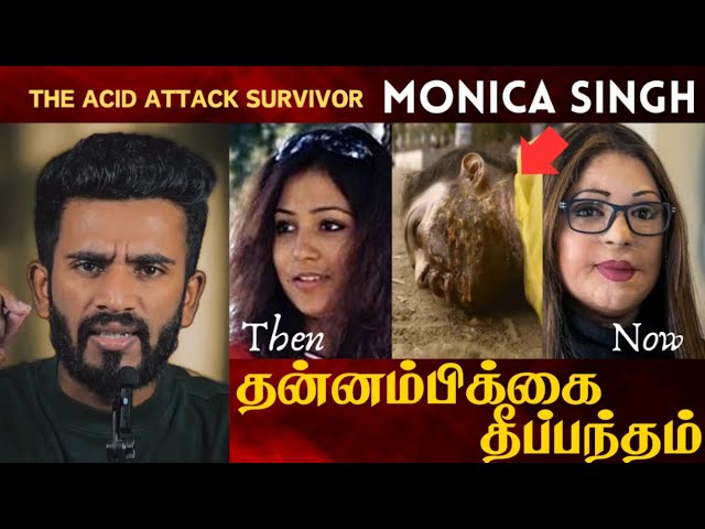 Monica Singh: The Unbreakable Spirit of an Acid Attack Survivor" |Voice of Raaz #motivation #tamil