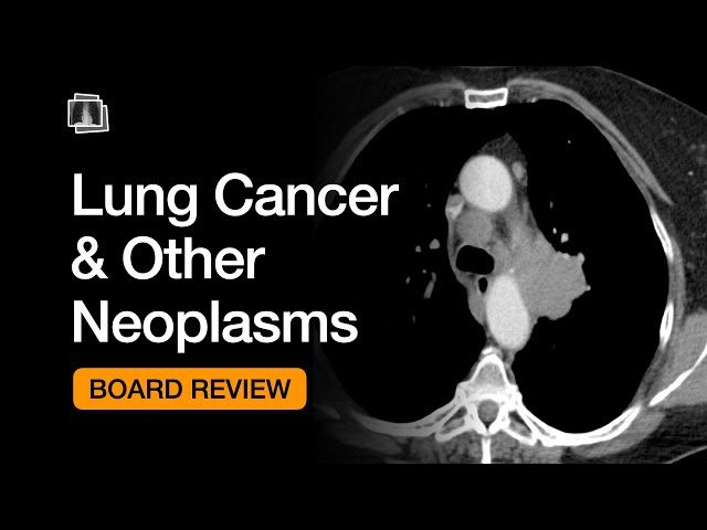 Lung Cancer & Other Neoplasms | Chest Radiology Board Review