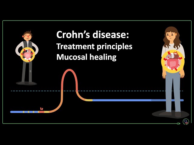 Crohn's disease: treatment principles and mucosal healing