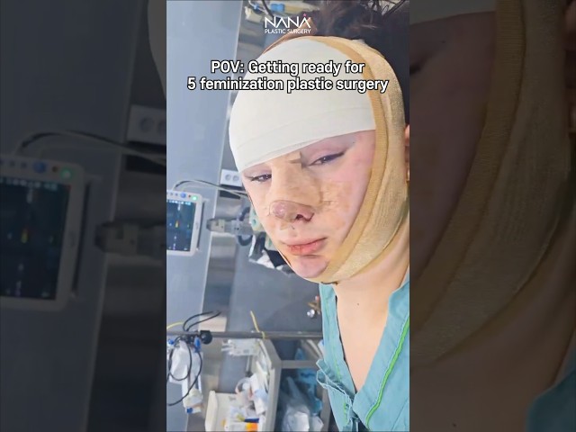 Having 5 facial feminization SURGERIES at ONCE?!