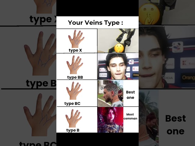 What is your Vein Type 👀