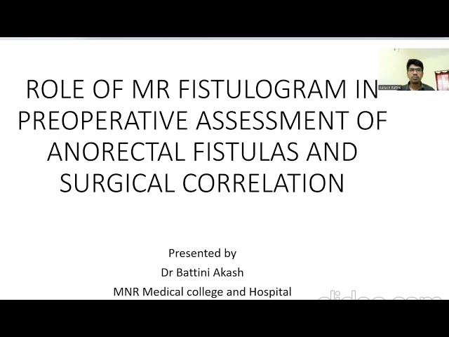 Battini Akash || MR in Ano Rectal Fistulas