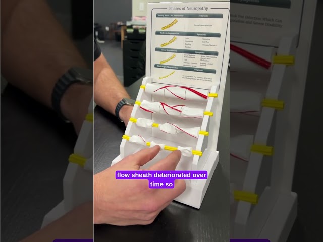 Do you have Neuropathy symptoms like numbness burning, or tingling? Nerve Damage Demonstration!