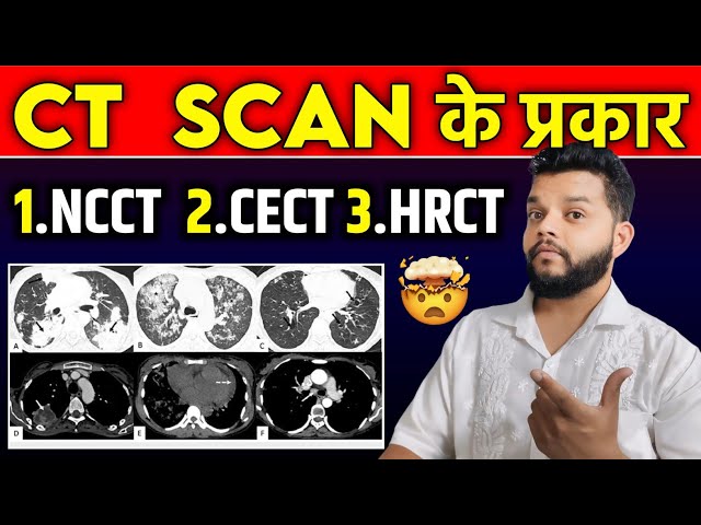 Types Of CT Scan In Hindi | CECT,NCCT & HRCT को समझिए क्या अंतर है