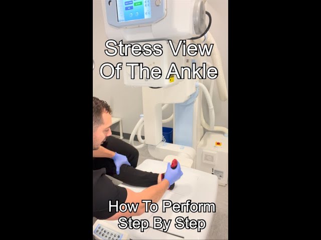 How To Perform A Stress View Of The Ankle On XR #shorts #xray #ortho