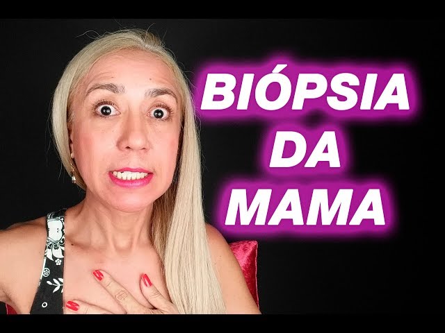 ❶ 😱 Biópsia da Mama: Será Que Toda Mulher Tem Que Fazer? Vanderlea Coelho - #Mastologia