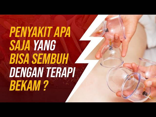 Penyakit Apa Saja yang Bisa Diterapi dengan Bekam ?