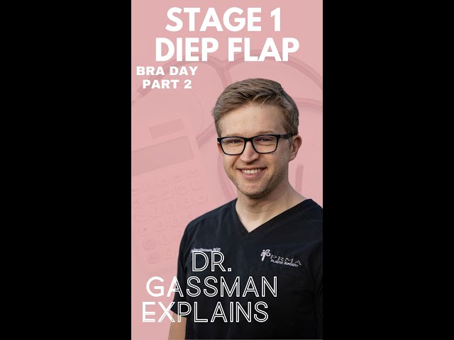 Stage 1 DIEP Flap