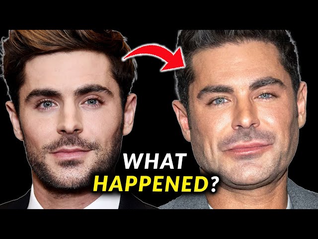 Zac Efron's Face - Before and After